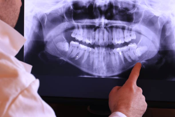 Best Emergency Tooth Extraction in Heavener, OK