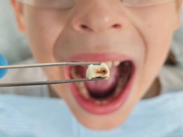Best After-Hours Emergency Dentist in Heavener, OK