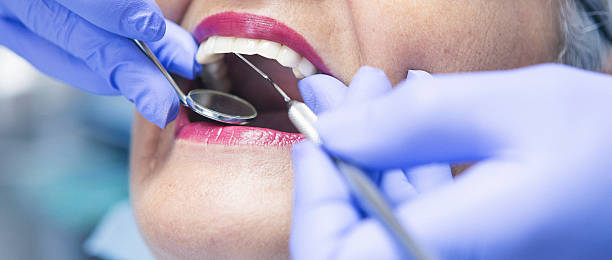 Best Emergency Wisdom Teeth Removal in Heavener, OK